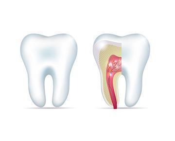 Diagram of healthy tooth and tooth with root infection near 27103